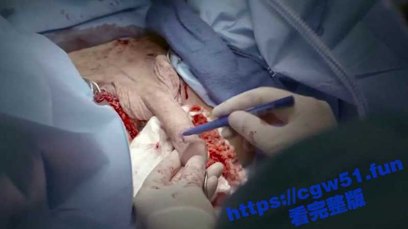 血腥重口 慎入！罕见的医院内部变性手术视频流出 全程皱眉看完 太痛了-51吃瓜网
